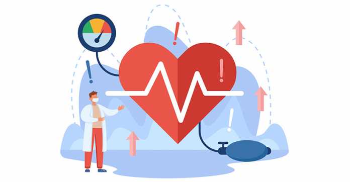 Holter EKG