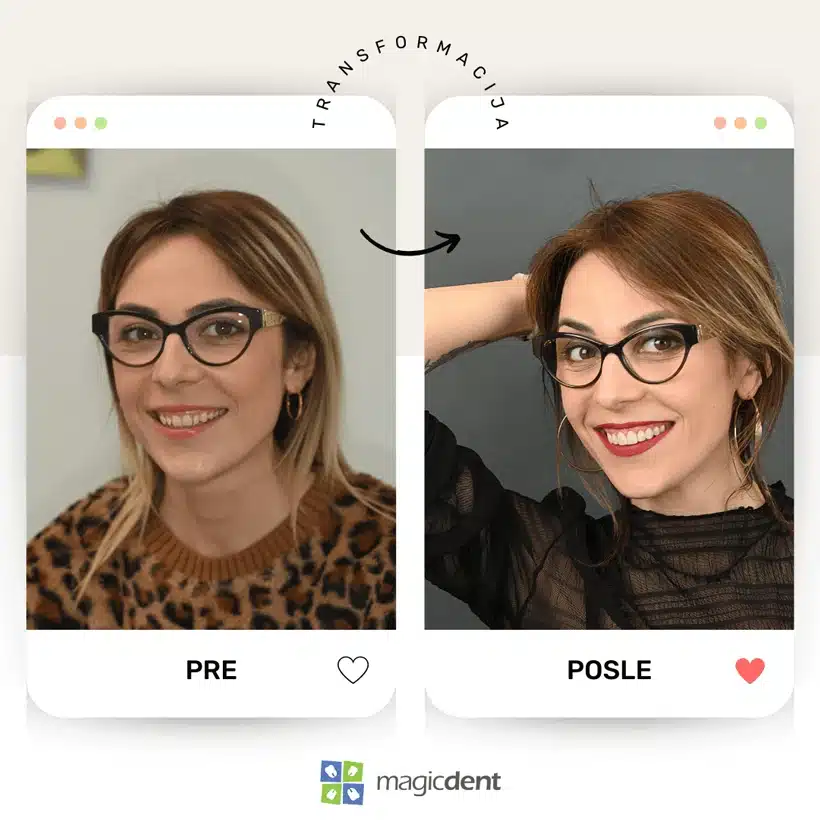 Magic Dent - Transformacija pre-posle